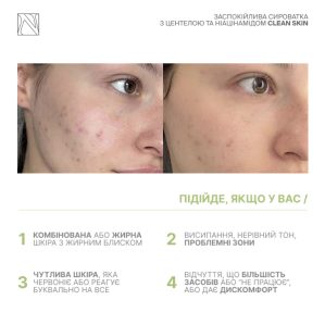 Alternative view of Заспокійлива сироватка з центелою та ніацинамідом CLEAN SKIN SERUM
